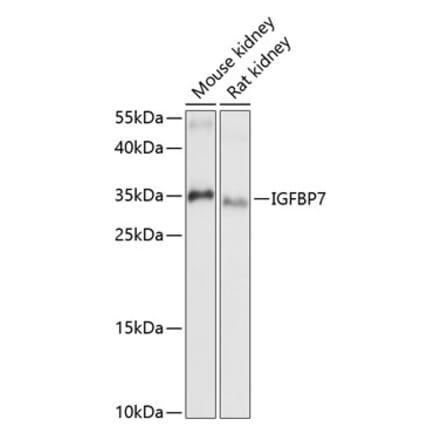 Western Blot - Anti-IGFBP7 Antibody (A89405) - Antibodies.com