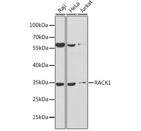 Western Blot - Anti-RACK1 Antibody (A89406) - Antibodies.com
