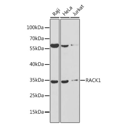 Western Blot - Anti-RACK1 Antibody (A89406) - Antibodies.com