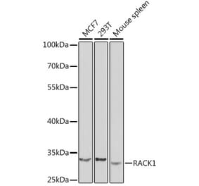 Western Blot - Anti-RACK1 Antibody (A89407) - Antibodies.com