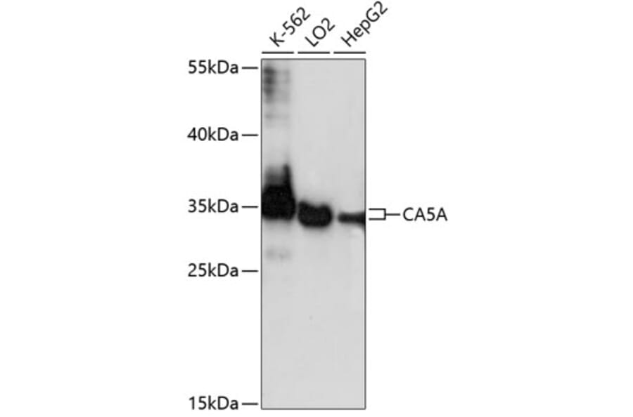 Western Blot - Anti-Carbonic Anhydrase 5A/CA5A Antibody (A89408) - Antibodies.com