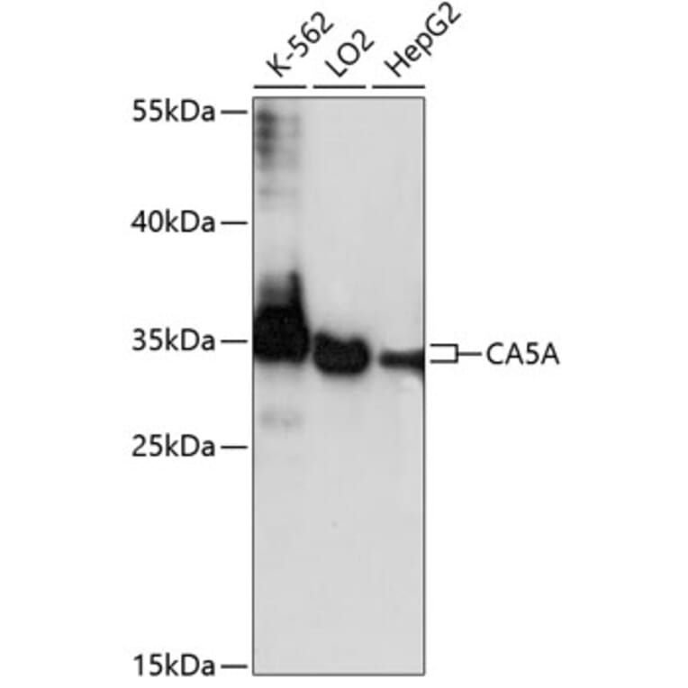 Western Blot - Anti-Carbonic Anhydrase 5A/CA5A Antibody (A89408) - Antibodies.com