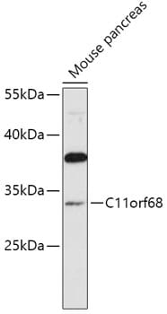 Western blot analysis of extracts of various cell lines, using Anti-C11orf68 Antibody (A16152) at 1:1,000 dilution.
Secondary antibody: Goat Anti-Rabbit IgG (H+L) (HRP) (AS014) at 1:10,000 dilution.
Lysates / proteins: 25µg per lane.
Blocking buffer: 3% non-fat dry milk in TBST.
Detection: ECL Basic Kit (RM00020).
Exposure time: 5s.