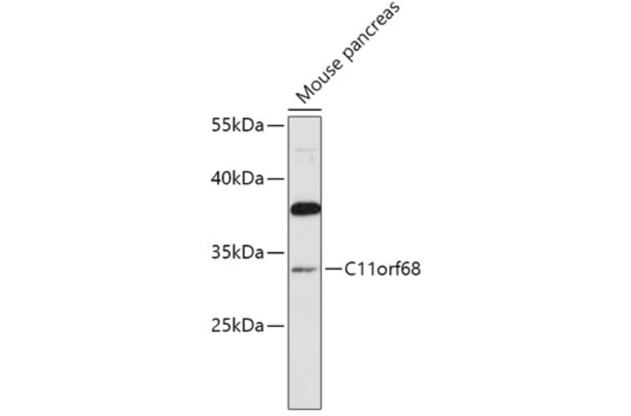Western Blot - Anti-CK068 Antibody (A89409) - Antibodies.com