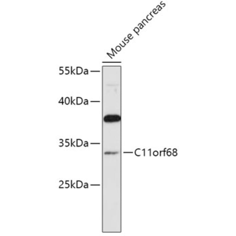 Western Blot - Anti-CK068 Antibody (A89409) - Antibodies.com