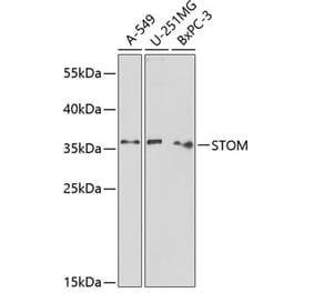 Western Blot - Anti-Stomatin Antibody (A89410) - Antibodies.com