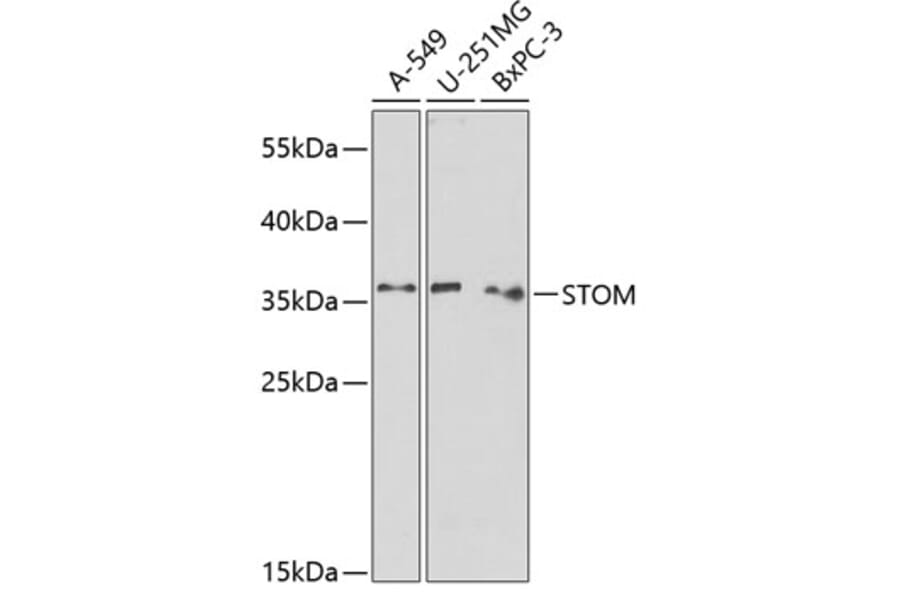 Western Blot - Anti-Stomatin Antibody (A89410) - Antibodies.com