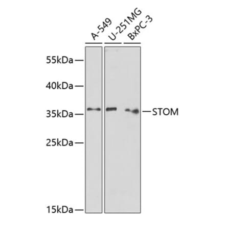 Western Blot - Anti-Stomatin Antibody (A89410) - Antibodies.com