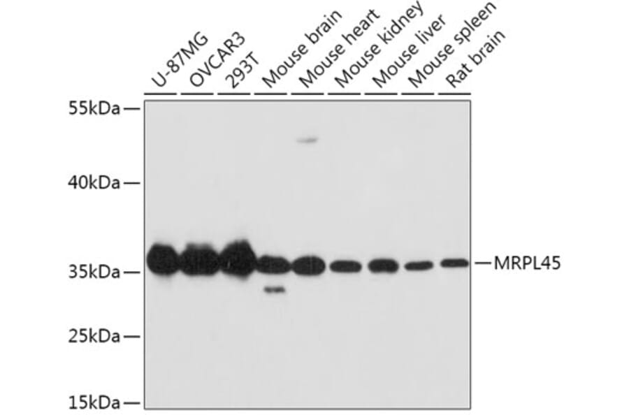 Western Blot - Anti-MRPL45 Antibody (A89411) - Antibodies.com