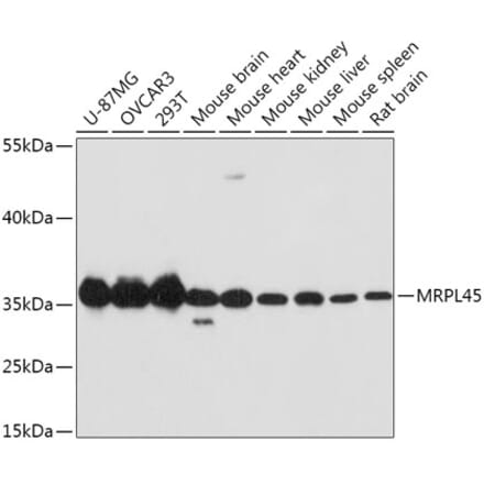Western Blot - Anti-MRPL45 Antibody (A89411) - Antibodies.com