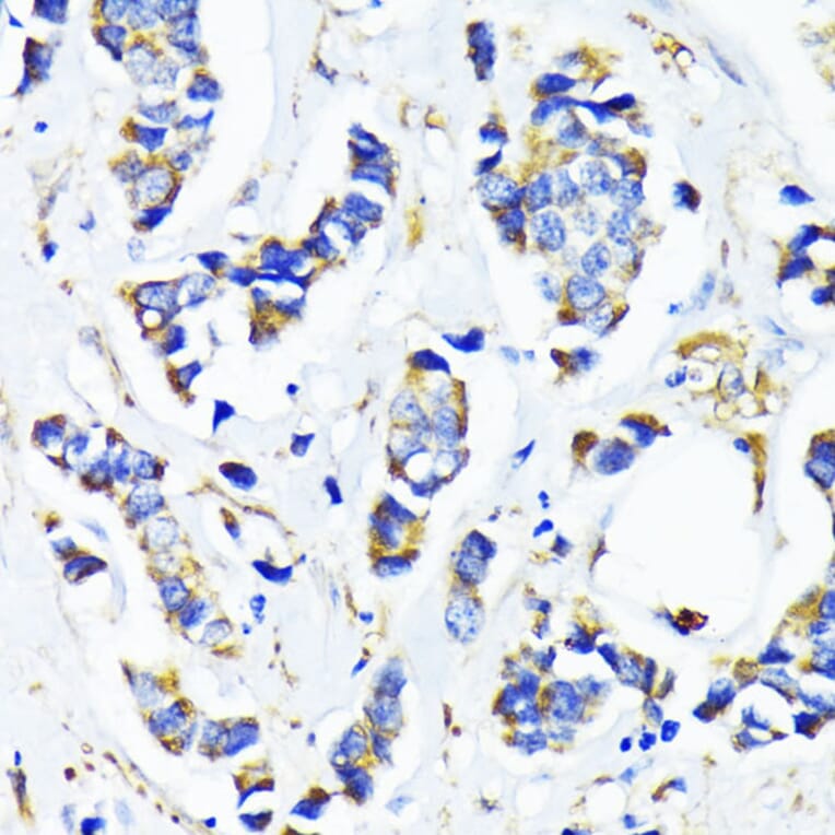Immunohistochemistry - Anti-MRPL45 Antibody (A89411) - Antibodies.com
