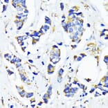 Immunohistochemistry - Anti-MRPL45 Antibody (A89411) - Antibodies.com