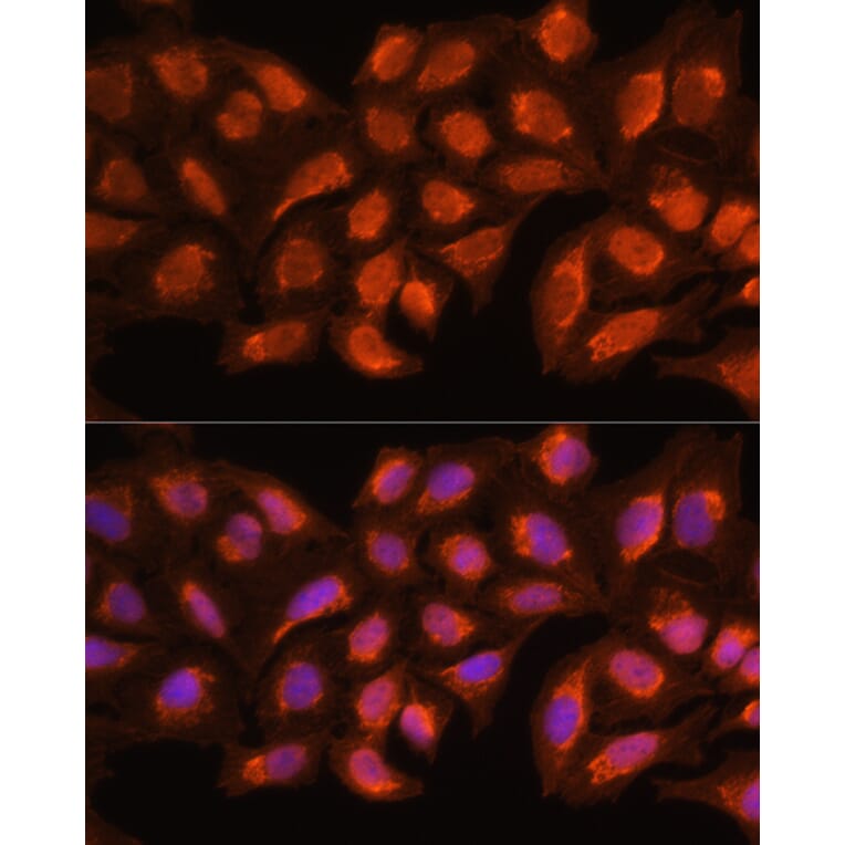 Immunofluorescence - Anti-MRPL45 Antibody (A89411) - Antibodies.com