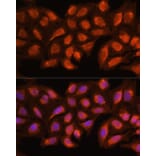 Immunofluorescence - Anti-MRPL45 Antibody (A89411) - Antibodies.com