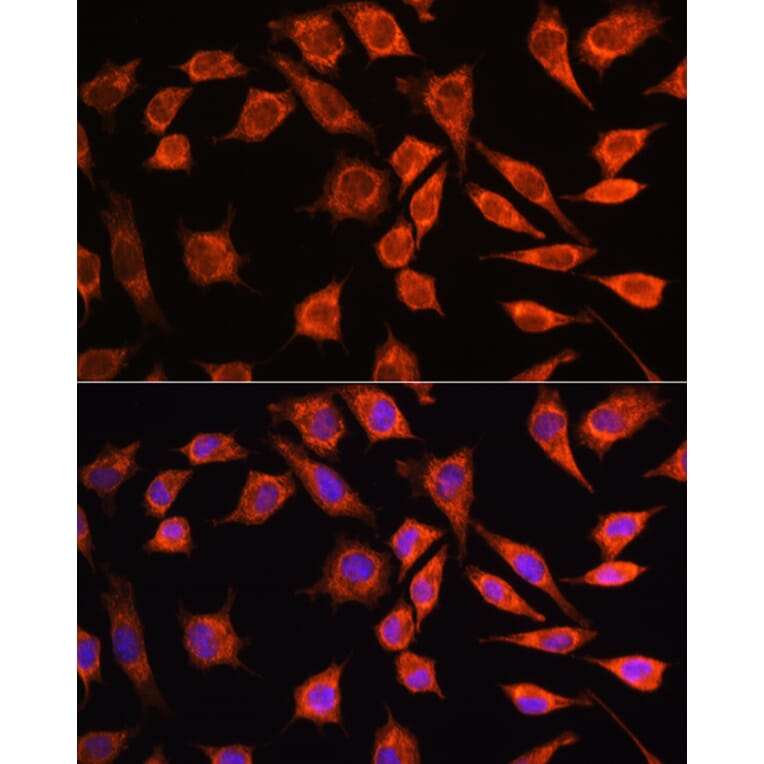Immunofluorescence - Anti-MRPL45 Antibody (A89411) - Antibodies.com