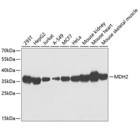 Western Blot - Anti-MDH2 Antibody (A89412) - Antibodies.com