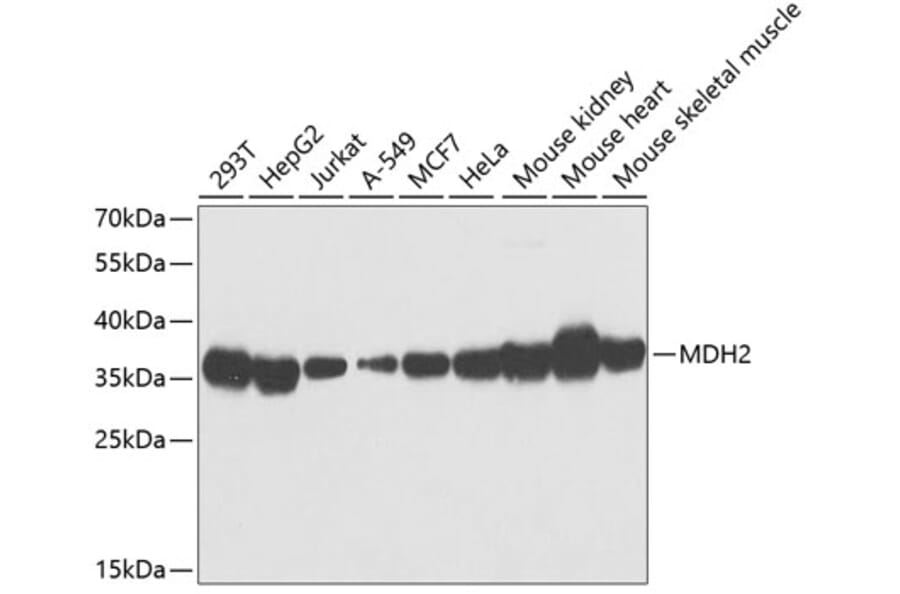 Western Blot - Anti-MDH2 Antibody (A89412) - Antibodies.com