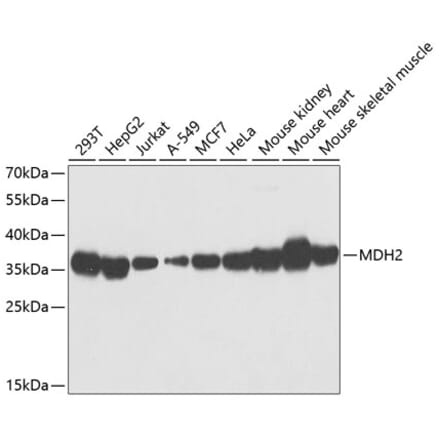 Western Blot - Anti-MDH2 Antibody (A89412) - Antibodies.com