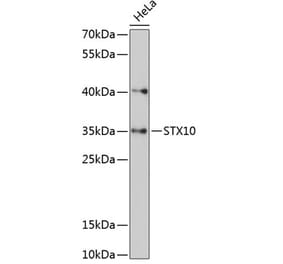 Western Blot - Anti-STX10 Antibody (A89413) - Antibodies.com