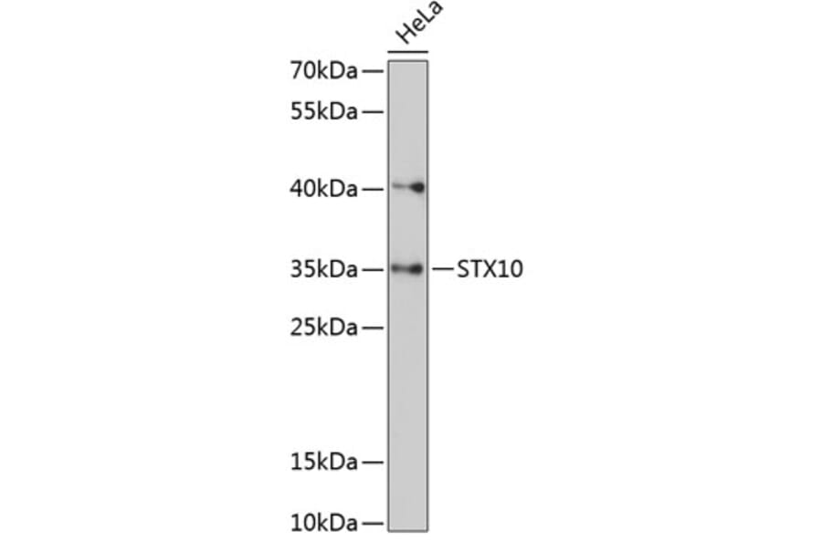 Western Blot - Anti-STX10 Antibody (A89413) - Antibodies.com