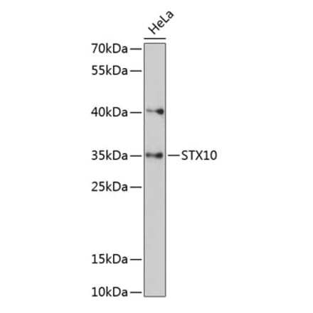 Western Blot - Anti-STX10 Antibody (A89413) - Antibodies.com
