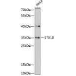Western Blot - Anti-STX10 Antibody (A89413) - Antibodies.com