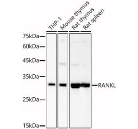 Western Blot - Anti-RANKL Antibody (A89414) - Antibodies.com