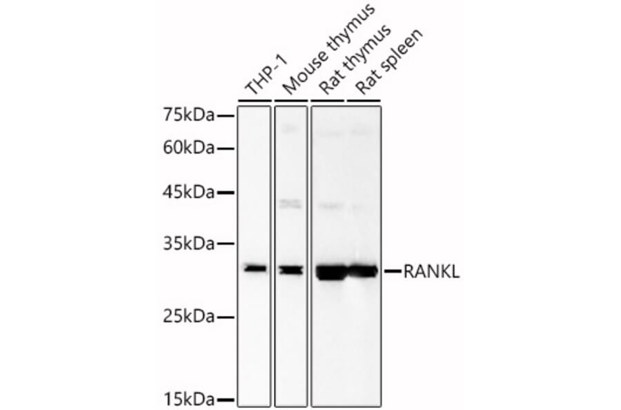Western Blot - Anti-RANKL Antibody (A89414) - Antibodies.com