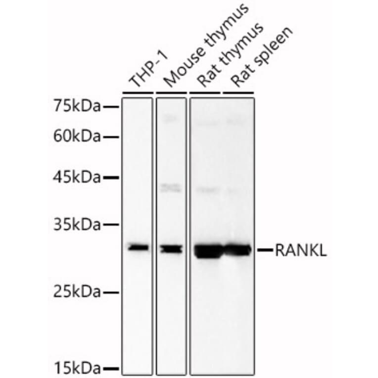 Western Blot - Anti-RANKL Antibody (A89414) - Antibodies.com