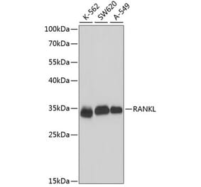 Western Blot - Anti-RANKL Antibody (A89415) - Antibodies.com