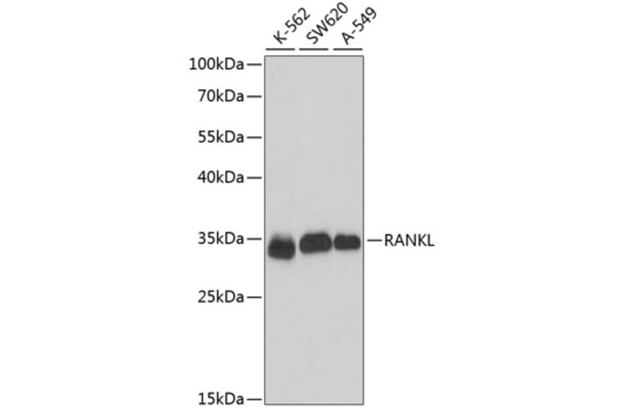 Western Blot - Anti-RANKL Antibody (A89415) - Antibodies.com