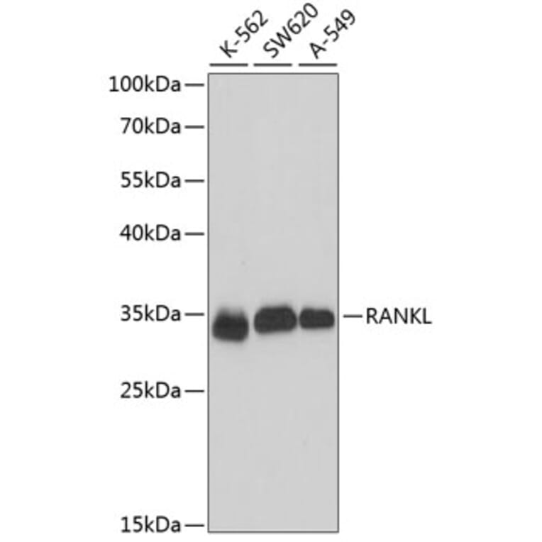 Western Blot - Anti-RANKL Antibody (A89415) - Antibodies.com