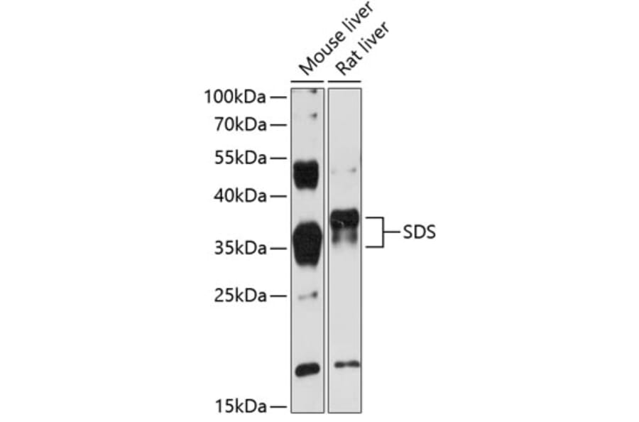 Western Blot - Anti-SDS Antibody (A89416) - Antibodies.com