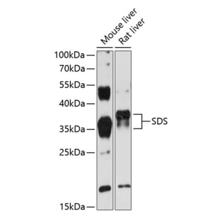 Western Blot - Anti-SDS Antibody (A89416) - Antibodies.com
