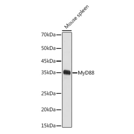 Western Blot - Anti-MyD88 Antibody (A89417) - Antibodies.com
