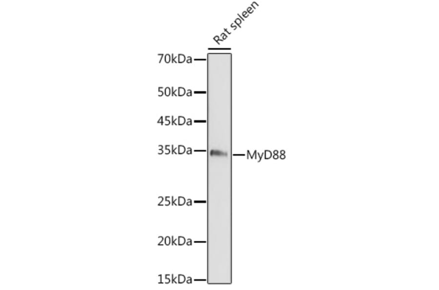 Western Blot - Anti-MyD88 Antibody (A89417) - Antibodies.com
