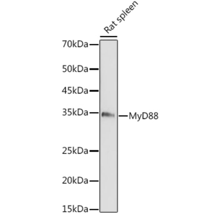 Western Blot - Anti-MyD88 Antibody (A89417) - Antibodies.com