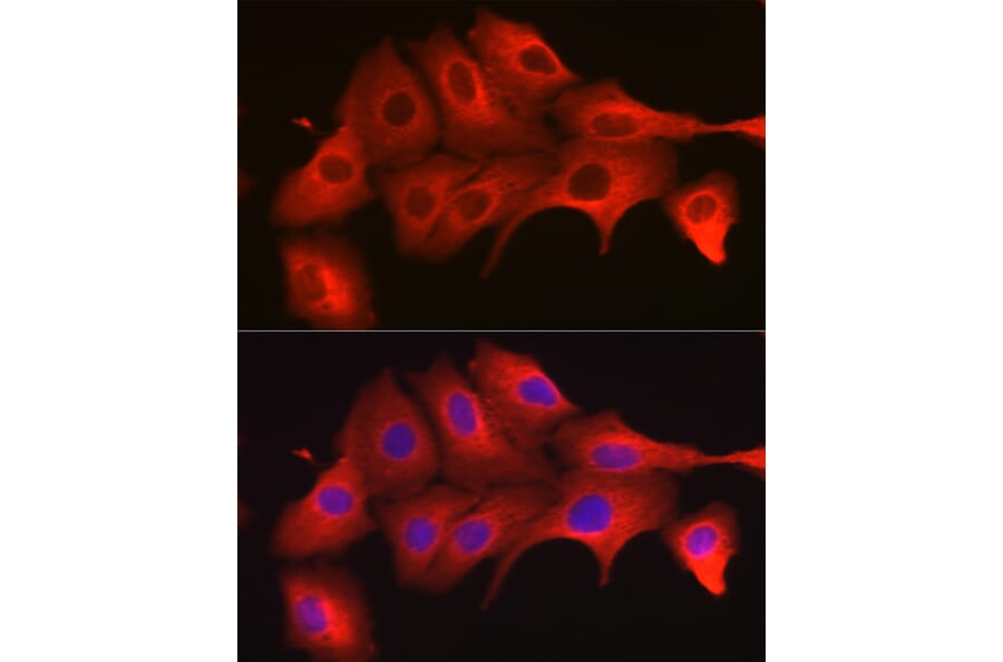 Immunofluorescence - Anti-MyD88 Antibody (A89417) - Antibodies.com