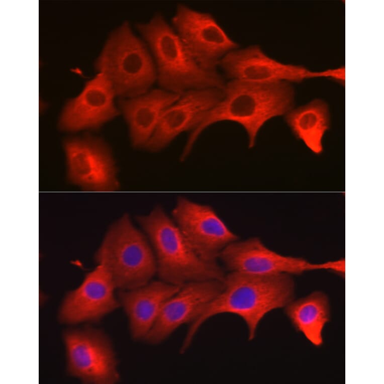 Immunofluorescence - Anti-MyD88 Antibody (A89417) - Antibodies.com