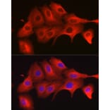 Immunofluorescence - Anti-MyD88 Antibody (A89417) - Antibodies.com
