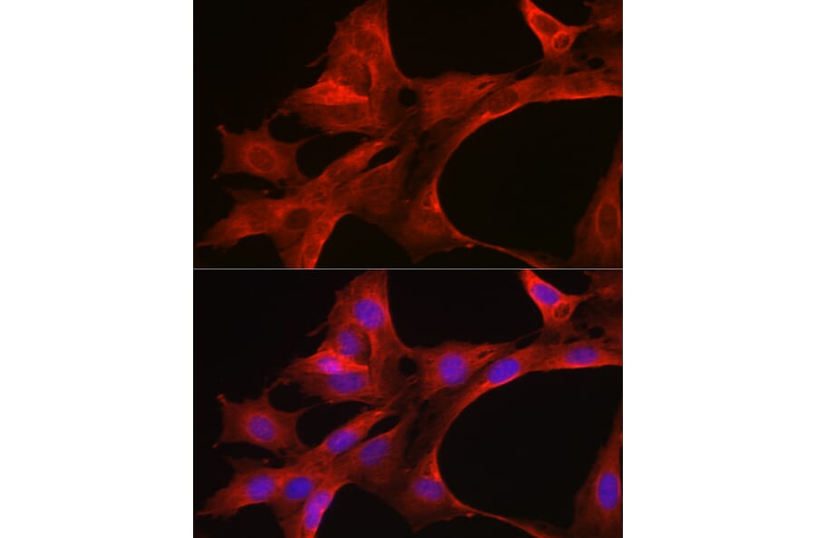 Immunofluorescence - Anti-MyD88 Antibody (A89417) - Antibodies.com