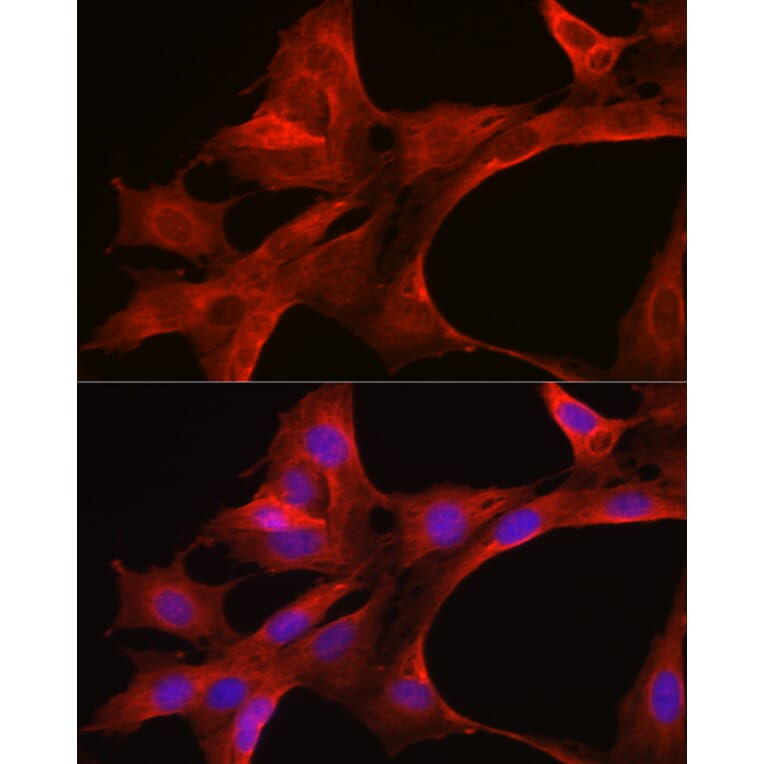 Immunofluorescence - Anti-MyD88 Antibody (A89417) - Antibodies.com