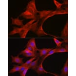 Immunofluorescence - Anti-MyD88 Antibody (A89417) - Antibodies.com