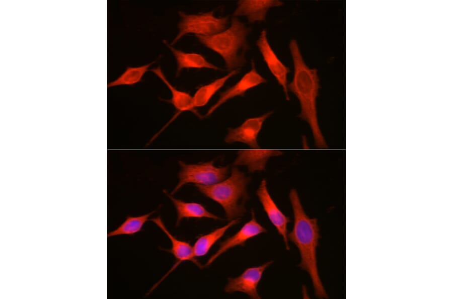 Immunofluorescence - Anti-MyD88 Antibody (A89417) - Antibodies.com