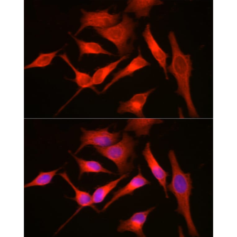 Immunofluorescence - Anti-MyD88 Antibody (A89417) - Antibodies.com