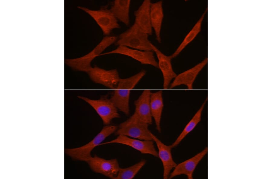 Immunofluorescence - Anti-MyD88 Antibody (A89417) - Antibodies.com