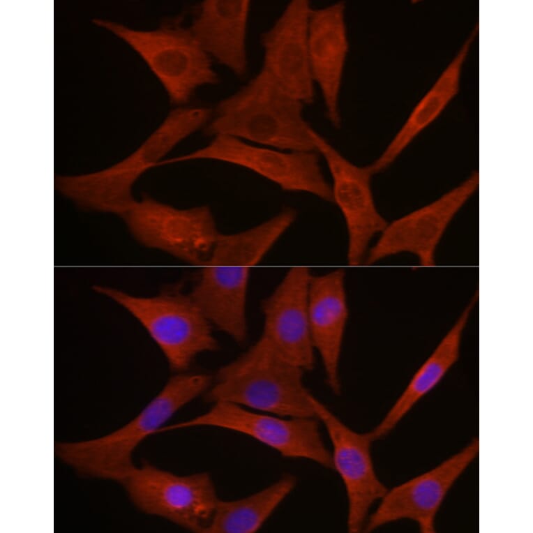 Immunofluorescence - Anti-MyD88 Antibody (A89417) - Antibodies.com