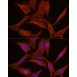 Immunofluorescence - Anti-MyD88 Antibody (A89417) - Antibodies.com