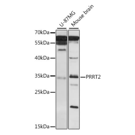 Western Blot - Anti-PRRT2 Antibody (A89419) - Antibodies.com