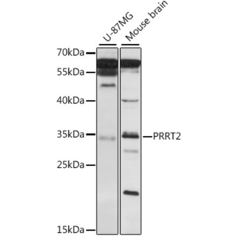 Western Blot - Anti-PRRT2 Antibody (A89419) - Antibodies.com